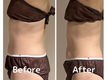 美活ラボ(美活LABO)/ビフォーアフター