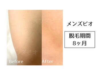 メンズビオ 神戸三宮店/