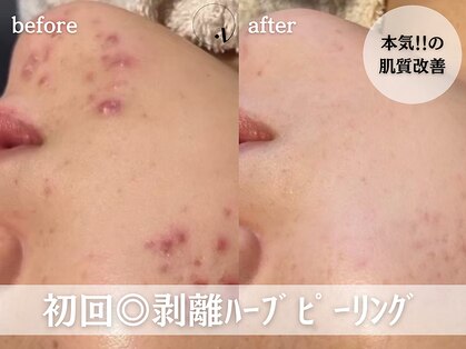 ボニータアンジュ 恵比寿(Bonita Ange)の写真