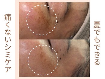 ココンフワット (Coconhouwat)