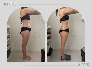 リー(Riy)/《Before and After》20代