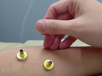 ホグステの写真/マッサージでは届かないコリや硬さ。動かすと痛い肩関節や慢性肩コリにお悩みの方へ。