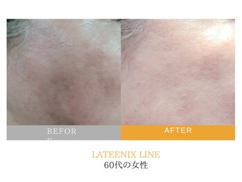 ワイズデュー(Y's Dew)/volayon黄：ラティニックス 美白