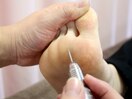ドイツ式フットケア