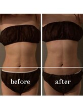 サントーシャ(Santosha)/骨盤の歪み解消！