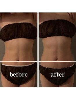 サントーシャ(Santosha)/骨盤の歪み解消!