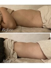 フルールドソレイユ(Fleur de Soleil)/慢性ストレスで身体がダル重い方