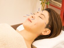 エスブランド 麻布十番(S-BRAND)/美容鍼