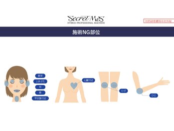 フェレザ 新潟(Felleza)/サーマルフラクショナルは