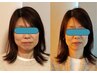 【大人気！】美容鍼＋頭蓋骨小顔矯正＋全身調整15,800→10,800【110分】