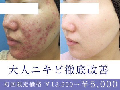 エピア 西尾店(Epia)の写真