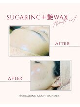 ワンダー(Wonder)/艶出しシュガーリングがオススメ