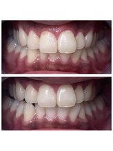 White base 【蘇我ホワイトニングサロン】/