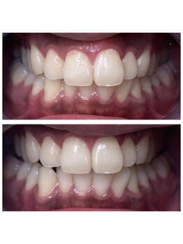 White base 【蘇我ホワイトニングサロン】/