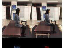 ストレチックス 近江八幡店/肩甲骨周りのコリ、首の痛み撃退