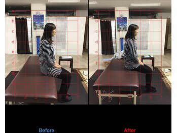 ストレチックス 近江八幡店/肩甲骨周りのコリ、首の痛み撃退
