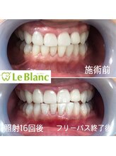 ルブラン 奈良店(Le Blanc)/回数券で通えます！