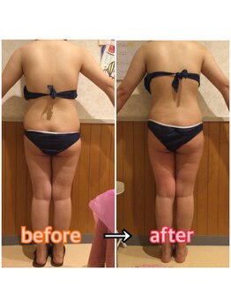 アンリール 旭川店(Anrire)/BODY施術のお客様です!