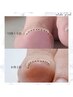 【巻き爪ケア継続でお得】親指2本巻き爪ケア※他の指の爪カット&ケア込み