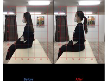 ストレチックス 近江八幡店/BeforeAfter