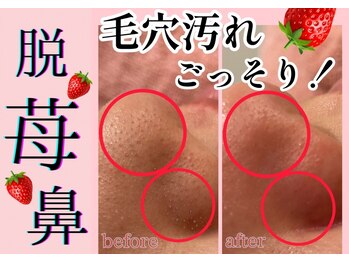 レティシア(Leticia)の写真/お肌が喜ぶ肌管理フェイシャル★お悩みに合わせて機械をセレクト♪すっぴんでも自信が持てるお肌に*