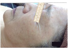 エスティフル 狭山店(ESTIFUL)/After/フェイシャル/マッサージ