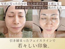 心音