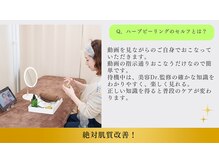 鍼灸院 はりエイト/◇ハーブピーリングのセルフとは