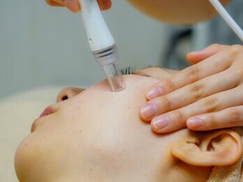 ダイアモンドフェイシャルアールプラス(Diamond Facial R+)の写真/《接近戦にも不安なし！》黒ずみ・角栓を徹底除去!!【毛穴洗浄＋毛穴吸引＋ダーマスクライバー】噂のEIEN★