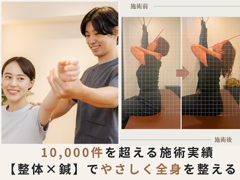 ハリデイズ/施術件数10,000件以上の実績!