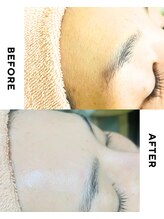 ワンダー(Wonder)/お悩み肌にはまず、角質ケア★