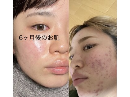 ラマジ(Lamazi)の写真