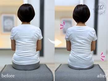 エーアール(AR)/【Before/After】4回目