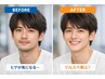 【学割U24】★ヒゲ全体(頬・鼻下・あご・あご下・もみあげ)都度払いで安心