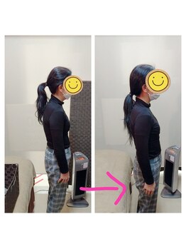 アリアーレ(ALIARE)/姿勢改善　５