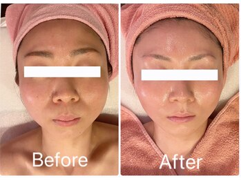 アルコイリス(Arco iris)/2年前と比べても一目稜線★