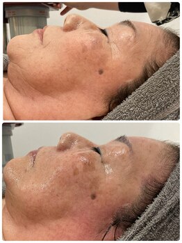 シェルビー(Cielbe.)/ファーストケアエステ＋フォト