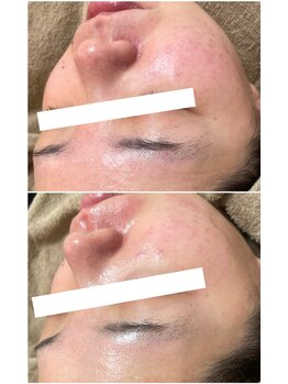 モンクラッシー(Mon classy)/