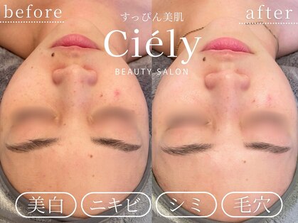 シエリー 原宿本店(Ciely)の写真