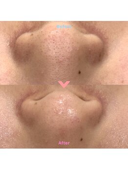 ルポアン(Repos an)/ハイドラワン