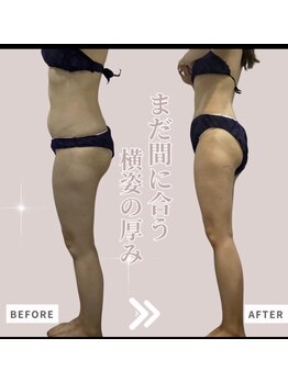 ソワン(Soin)/30代　中半身