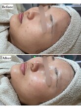 ソワナ(soina)/【神楽坂駅/フェイシャル/毛穴】