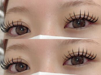 アイラブ バイ ネイロ 北千住(eye Love by NeiRo)/バインドロック