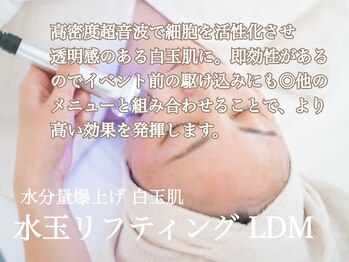 チップ(chip)/【LDM/水玉リフティング】