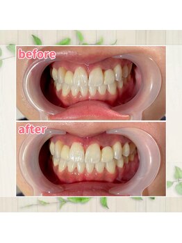 パルティービューティー 天満店(PARTIE BEAUTY)/お客様の変化をお届け【No.5】