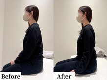 ソレア(Solea)/首こり・肩こり・姿勢改善１回目