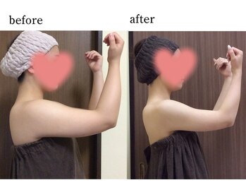 ウィズマツオカ 光の森店/二の腕、背中集中！