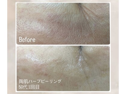 ルミナ(Lumina)の写真