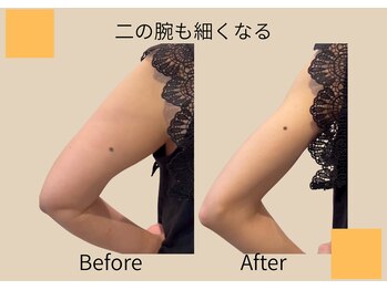ヨサパーク ココロ 町田店(YOSA PARK COCORO)/二の腕も痩せる Beforeafter