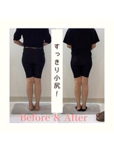 スタイルラボ高松/産後骨盤矯正の効果♪